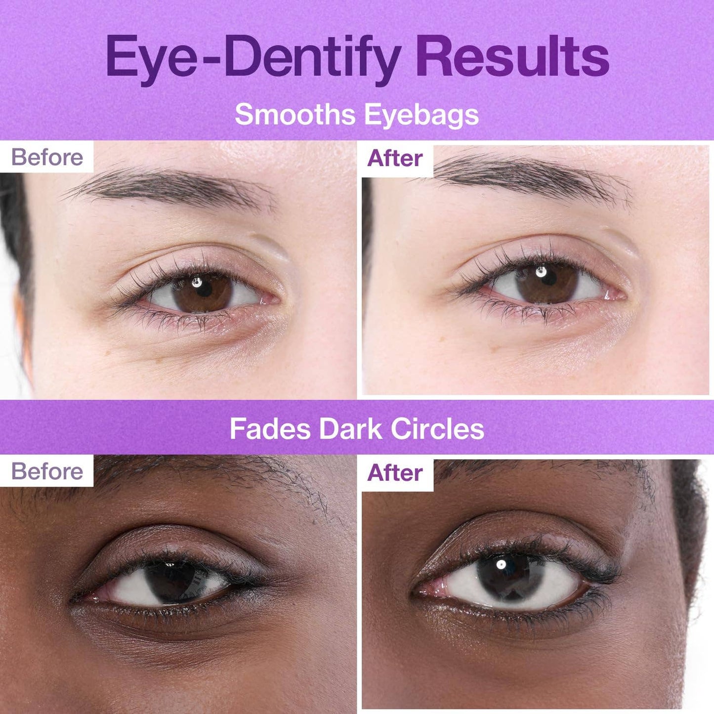 NAD+ Collagen Under Eye Patches 5 Pairs